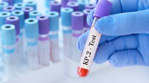 Nova Variante da COVID-19 KP.2: O Que Se Sabe Até Agora?