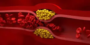 Como Baixar o Colesterol Ruim (LDL) Naturalmente: Dicas Comprovadas pela Ciência