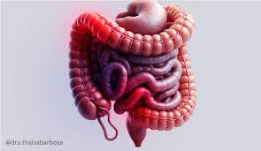 Intestino irritável
