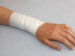 Queimaduras: Tipos, Causas, Tratamento e Prevenção para uma Vida Mais Segura | Viva Melhor Hoje