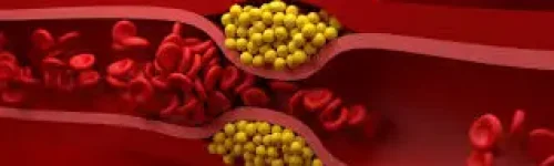 Como Baixar o Colesterol Ruim (LDL) Naturalmente: Dicas Comprovadas pela Ciência
