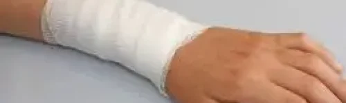 Queimaduras: Tipos, Causas, Tratamento e Prevenção para uma Vida Mais Segura | Viva Melhor Hoje