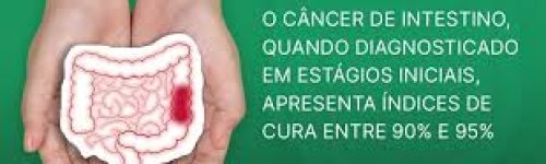Câncer de Intestino: O Papel dos Anti-inflamatórios na Prevenção da Recidiva